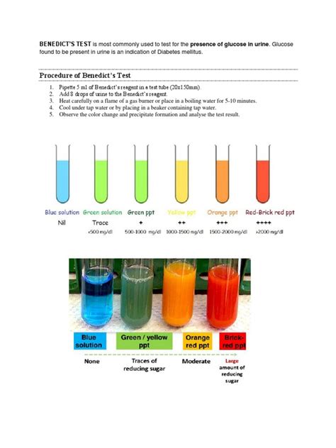 Acetic ACID TEST .